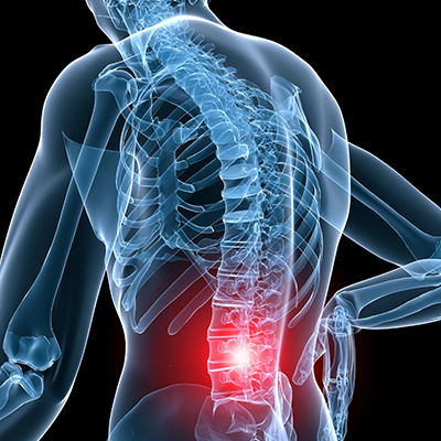 spinal trauma kalra brain and spine