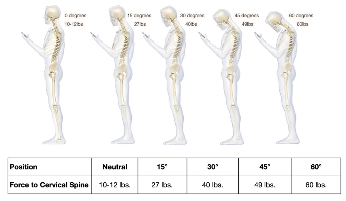 Chart showing force on the cervical spine rising from 10–12 lbs at a neutral head position to 60 lbs at a 60° forward tilt